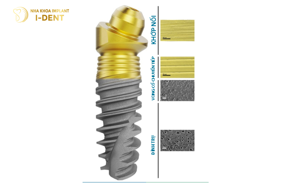 Trụ Implant Nobel Biocare