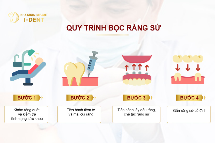 bọc sứ răng cửa giá bao nhiêu - Quy trình bọc răng sứ