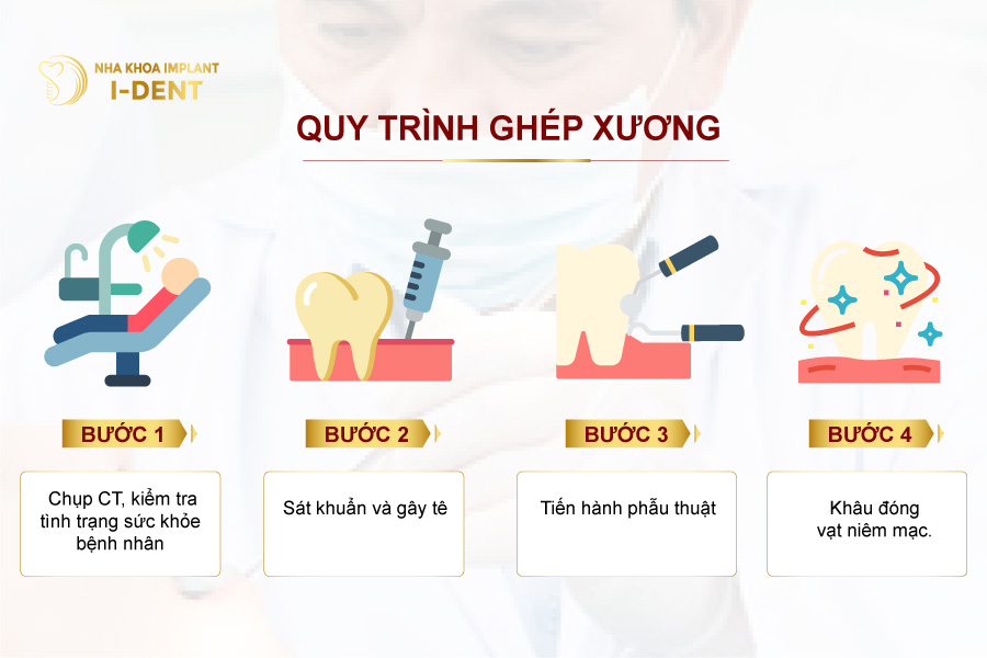 Quy trình ghép xương tại nha khoa I-Dent