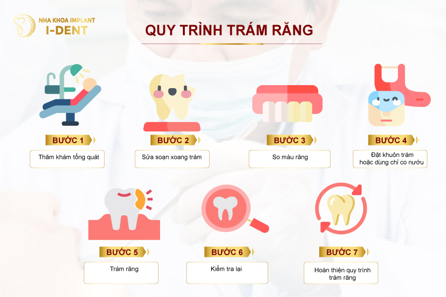 Quy trình trám răng thẩm mỹ