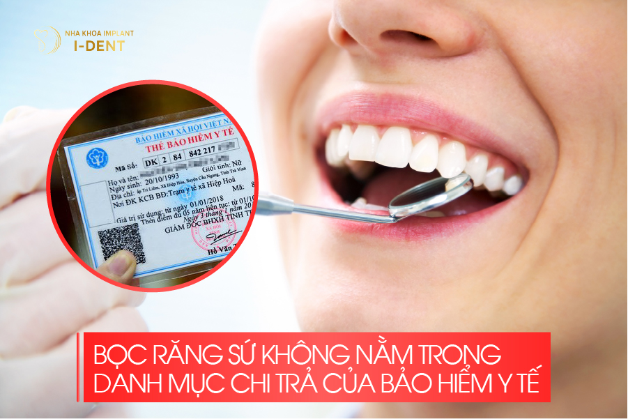 Bọc răng sứ không nằm trong danh mục chi trả của bảo hiểm y tế