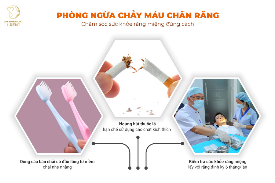 Cách phòng ngừa chảy máu chân răng