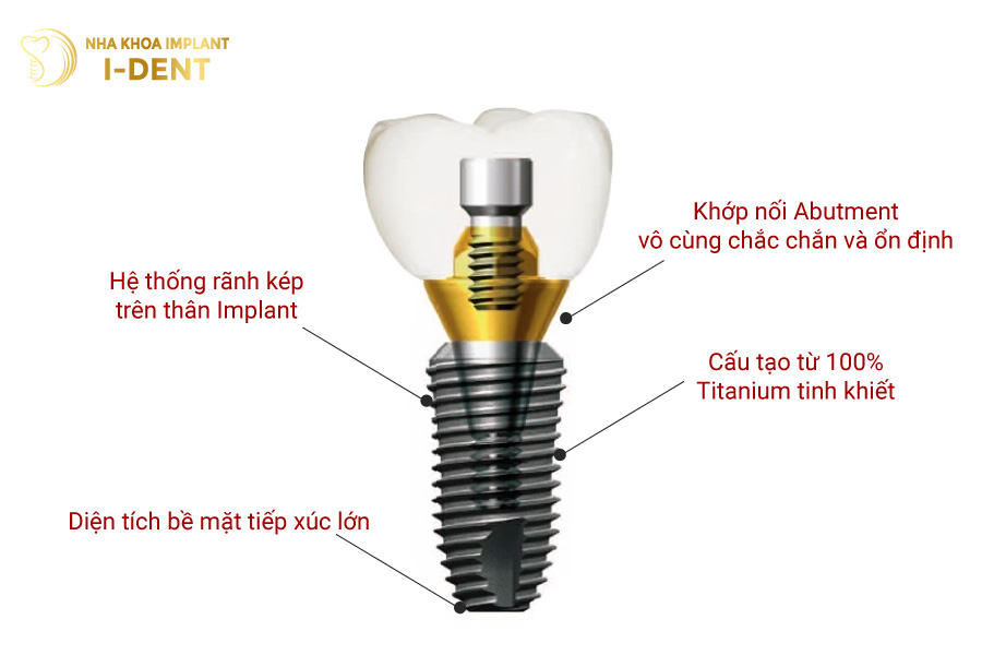 Thân trụ Dentium Mỹ có các rãnh kép, giúp tích hợp xương nhanh chóng hơn 