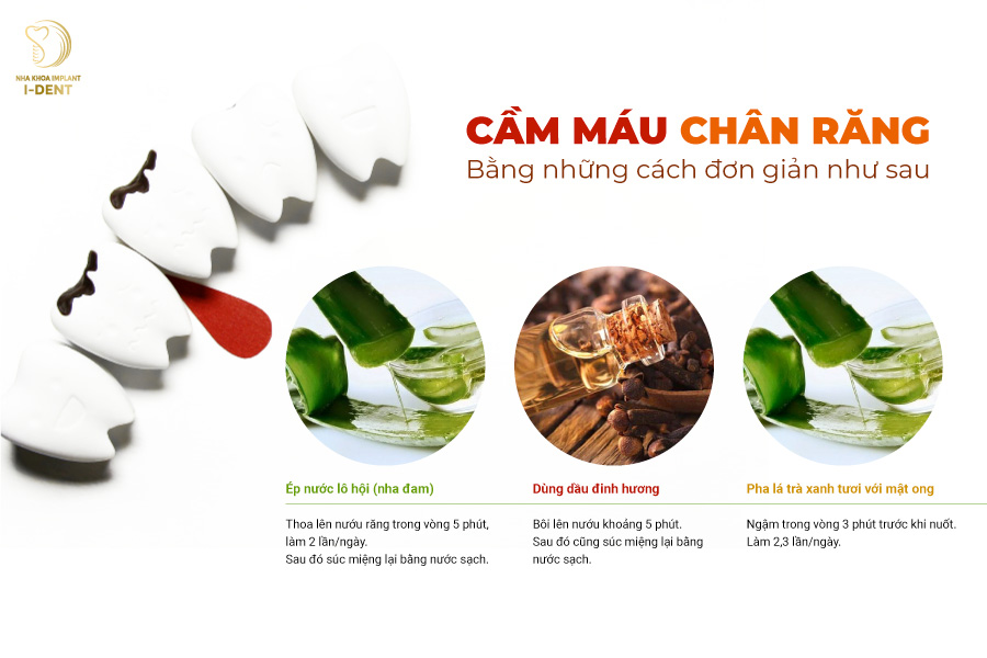 Những cách cầm máu chân răng đơn giản