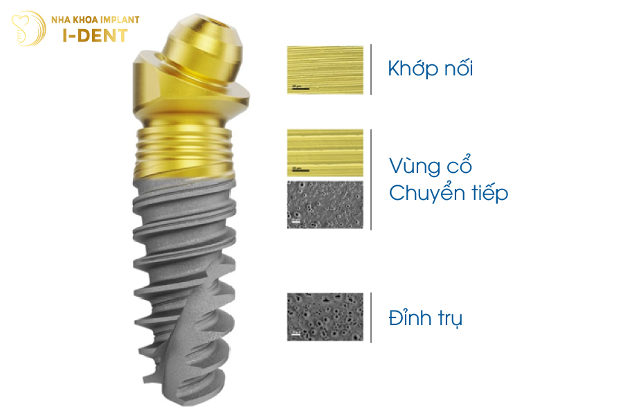 Implant Nobel Biocare