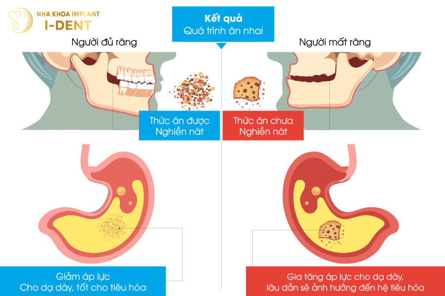 Thức ăn khó được nghiền nhỏ do mất răng