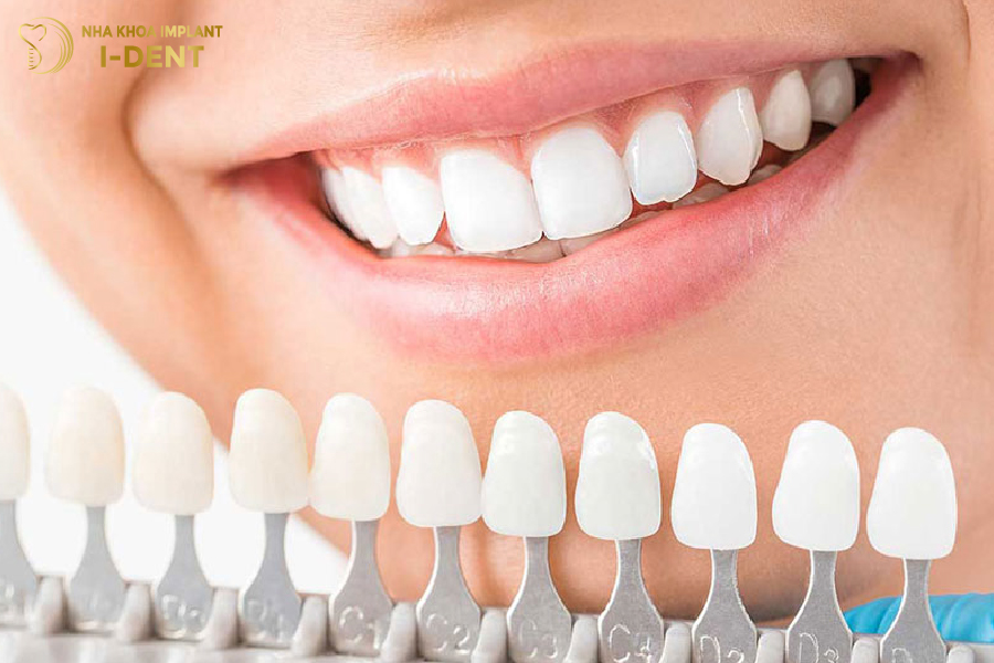 Mỗi nha khoa sẽ có giá bọc răng sứ HT Smile khác nhau