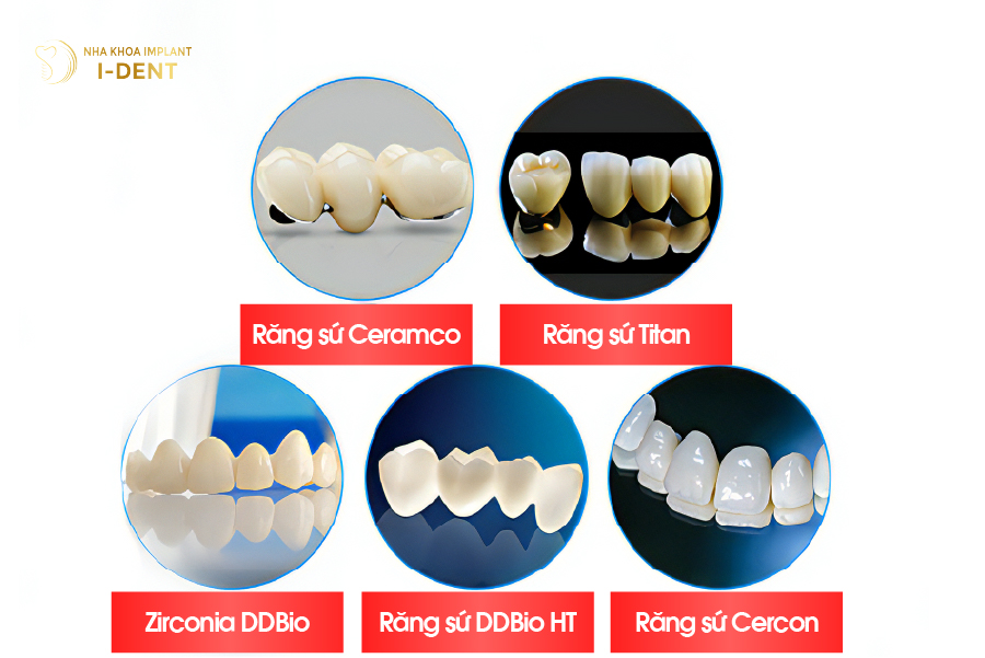  Một số dòng răng sứ tại nha khoa I-DENT