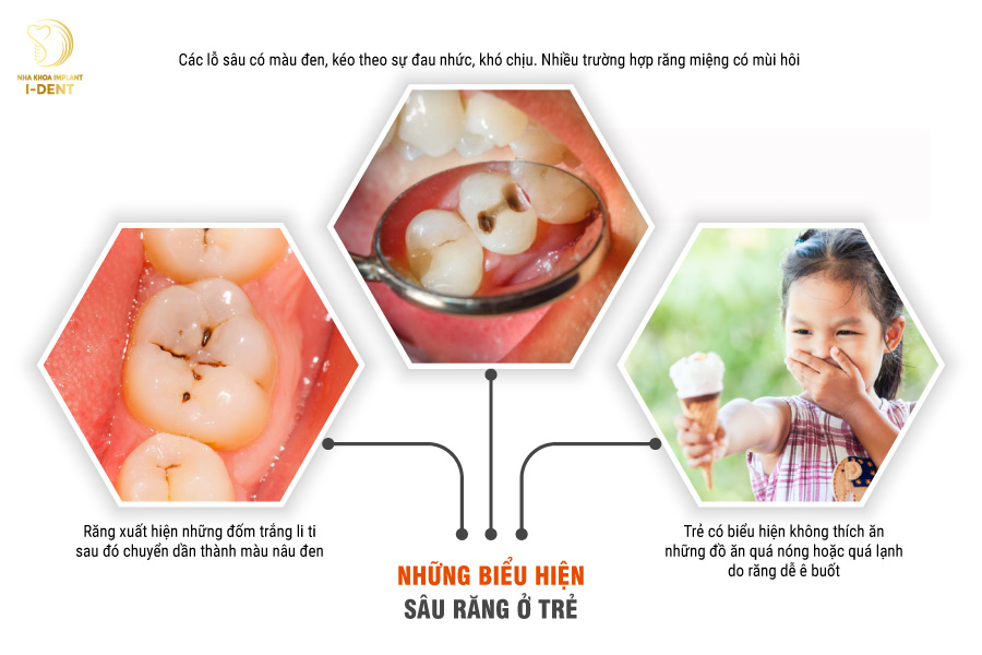 Những biểu hiện sâu răng ở trẻ nhỏ