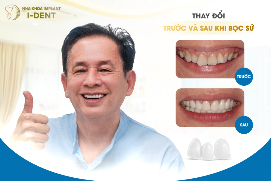 khách hàng sau khi bọc răng sứ tại Nha khoa I-DENT