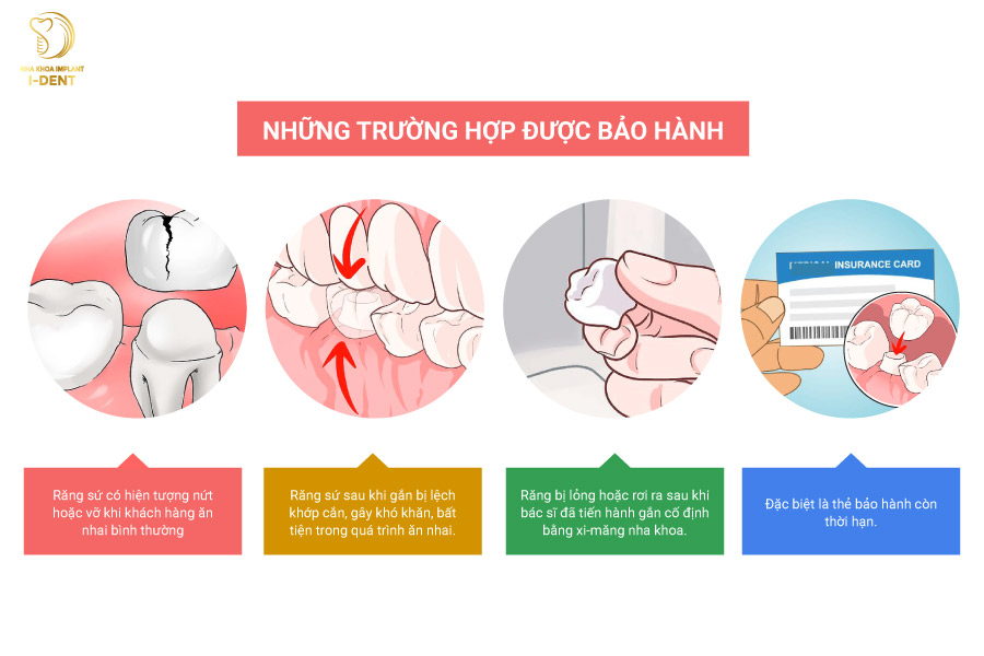 Những trường hợp được bảo hành răng sứ