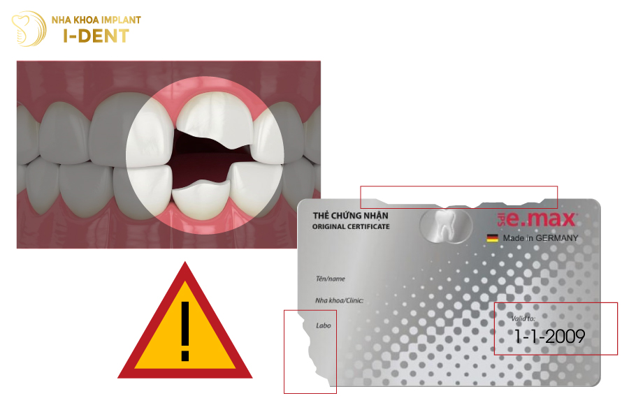 Những trường hợp thẻ bảo hành răng sứ emax không có hiệu lực