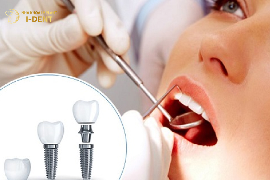 Phải đảm bảo sức khỏe mới có thể trồng Implant sau khi nhổ răng