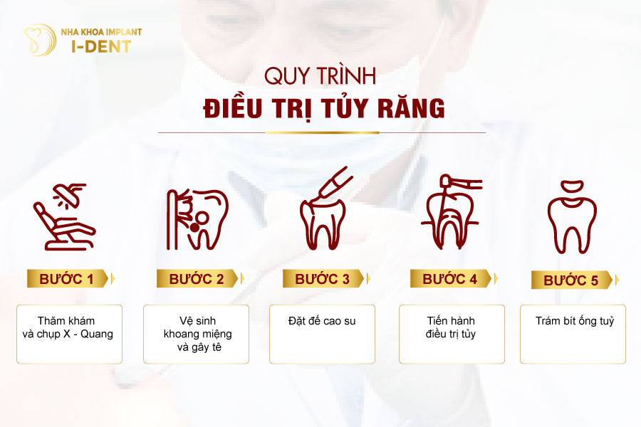 Quy trình điều trị tủy tại Nha khoa I - DENT