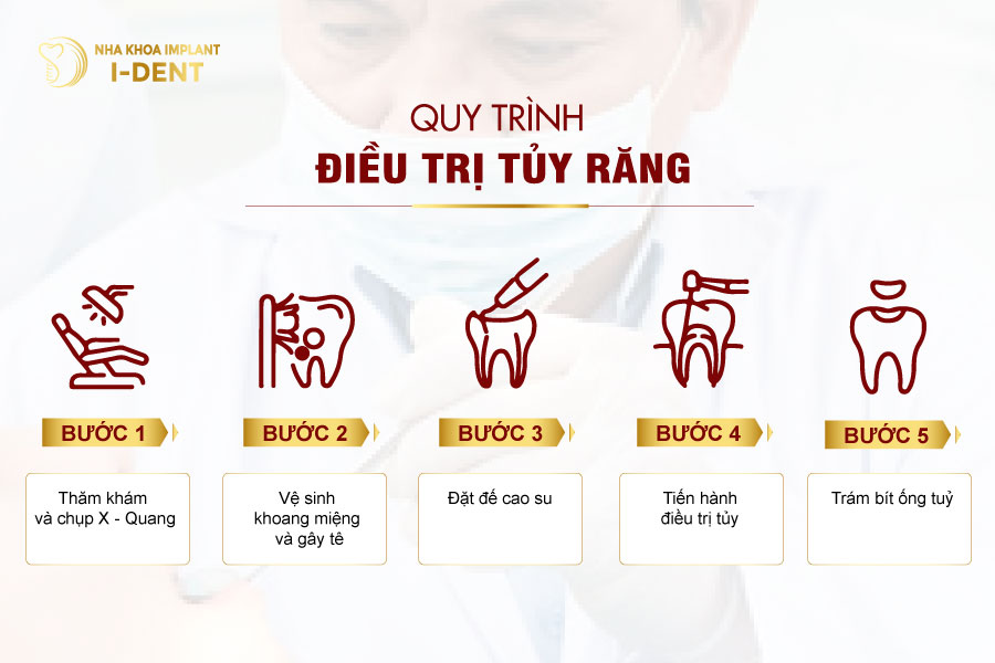 Quy trình điều trị tủy răng tiêu chuẩn tại nha khoa I-DENT