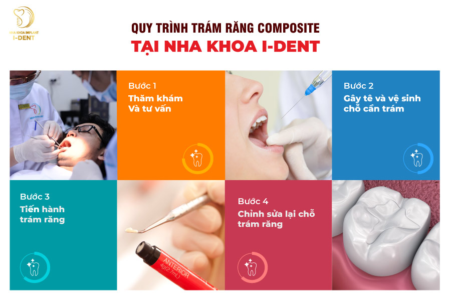 Quy trình trám răng Composite tại Nha khoa I-DENT