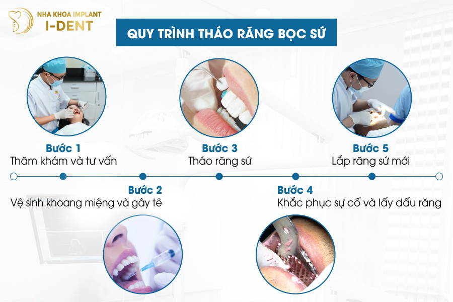 Cách tháo răng bọc sứ như thế nào?