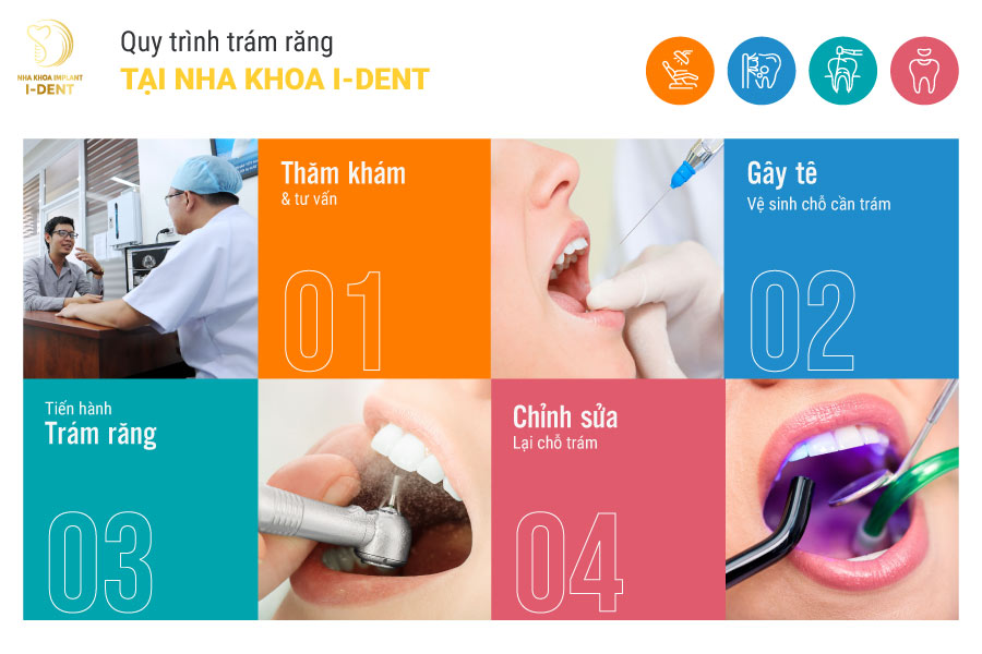 Quy trình trám răng tại Nha khoa I-DENT 