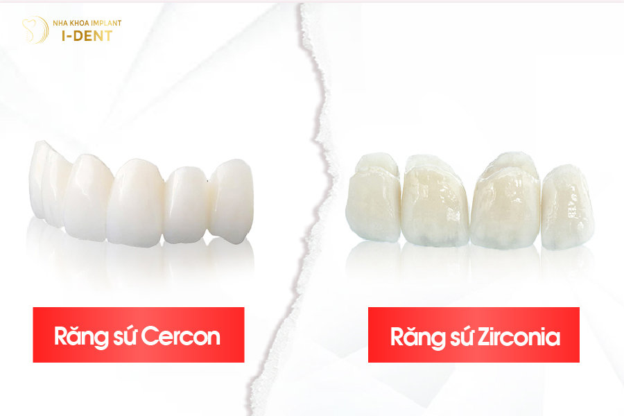 Răng sứ Cercon và răng sứ Zirconia