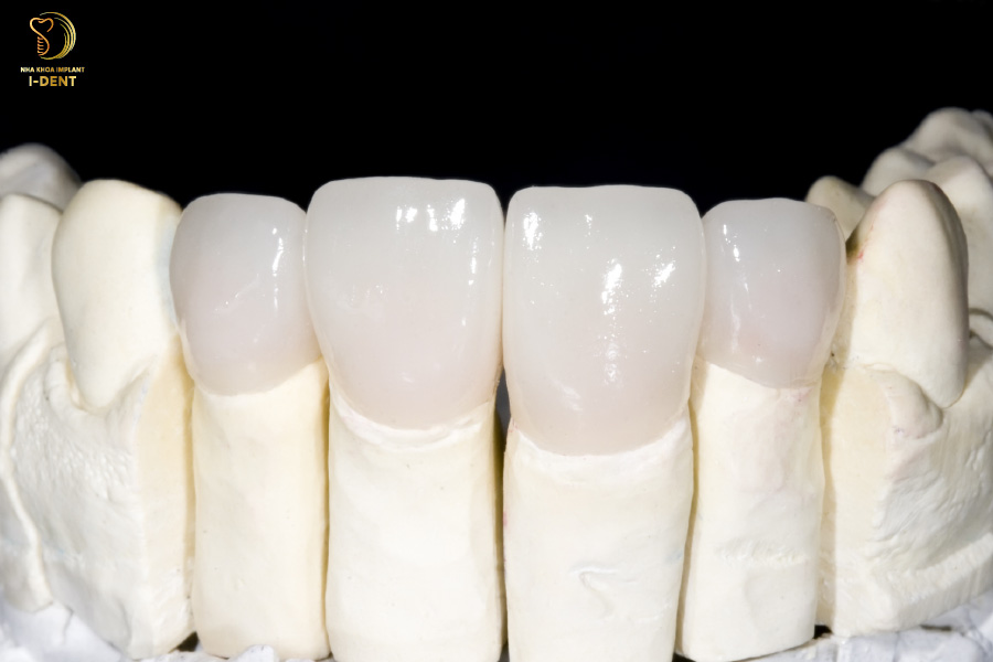 Răng sứ Zirconia