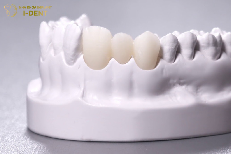 Răng sứ Zirconia