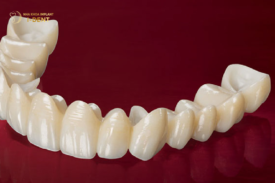 Răng sứ Zirconia cải thiện thẩm mỹ vùng răng nhai