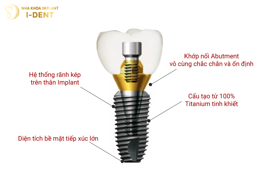 Trụ Implant Dentium Superline Mỹ