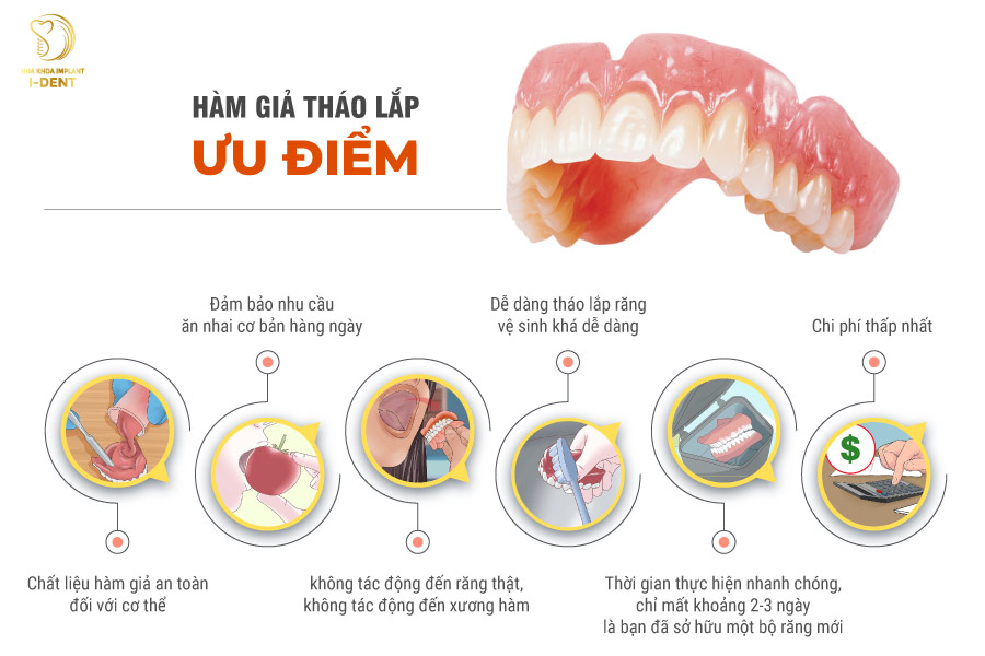 Ưu điểm của phương pháp làm răng giả tháo lắp