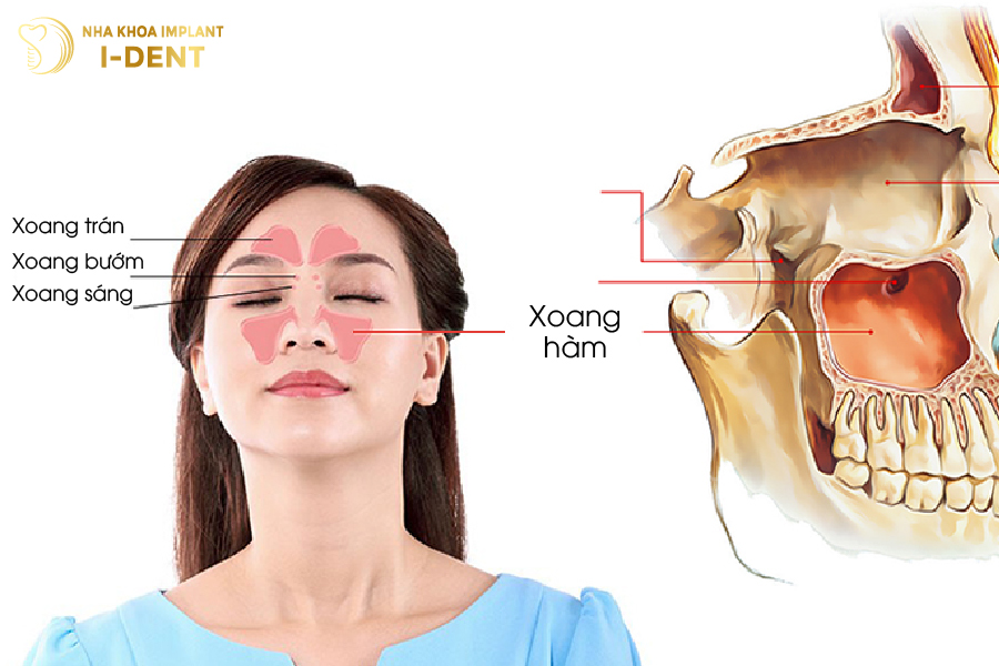 Vị trí của xoang hàm