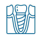Quy trình đặt trụ Implant Quy trình đặt trụ Implant