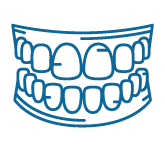 Quy trình đặt trụ Implant Quy trình đặt trụ Implant