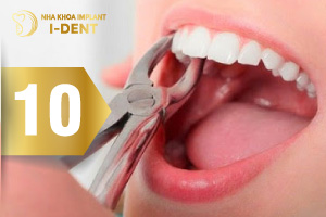 10 Điều Cần Biết Sau Khi Nhổ Răng Cửa