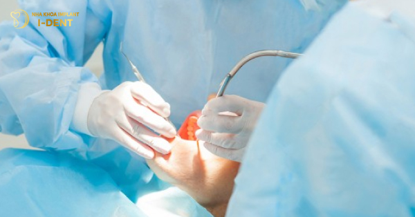 Cần Lưu Ý Những Gì Khi Trồng Răng Implant?