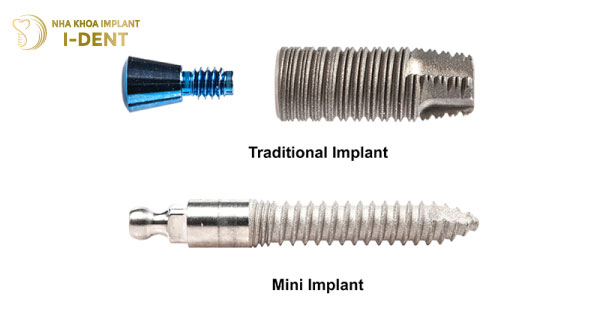 Cấy Ghép Mini Implant Có Khác Biệt Gì So Với Implant Thông Thường?